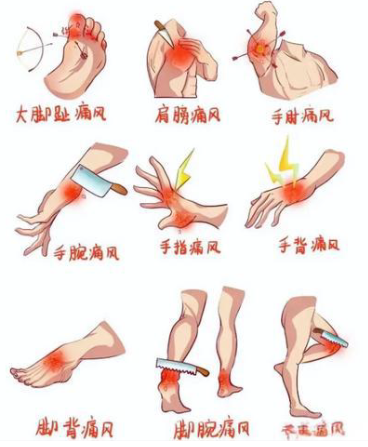 【健康科普】别再硬扛···